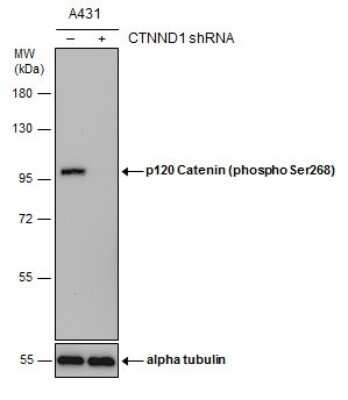 Western Blot: p120-catenin [p Ser268] Antibody [NBP3-12923]